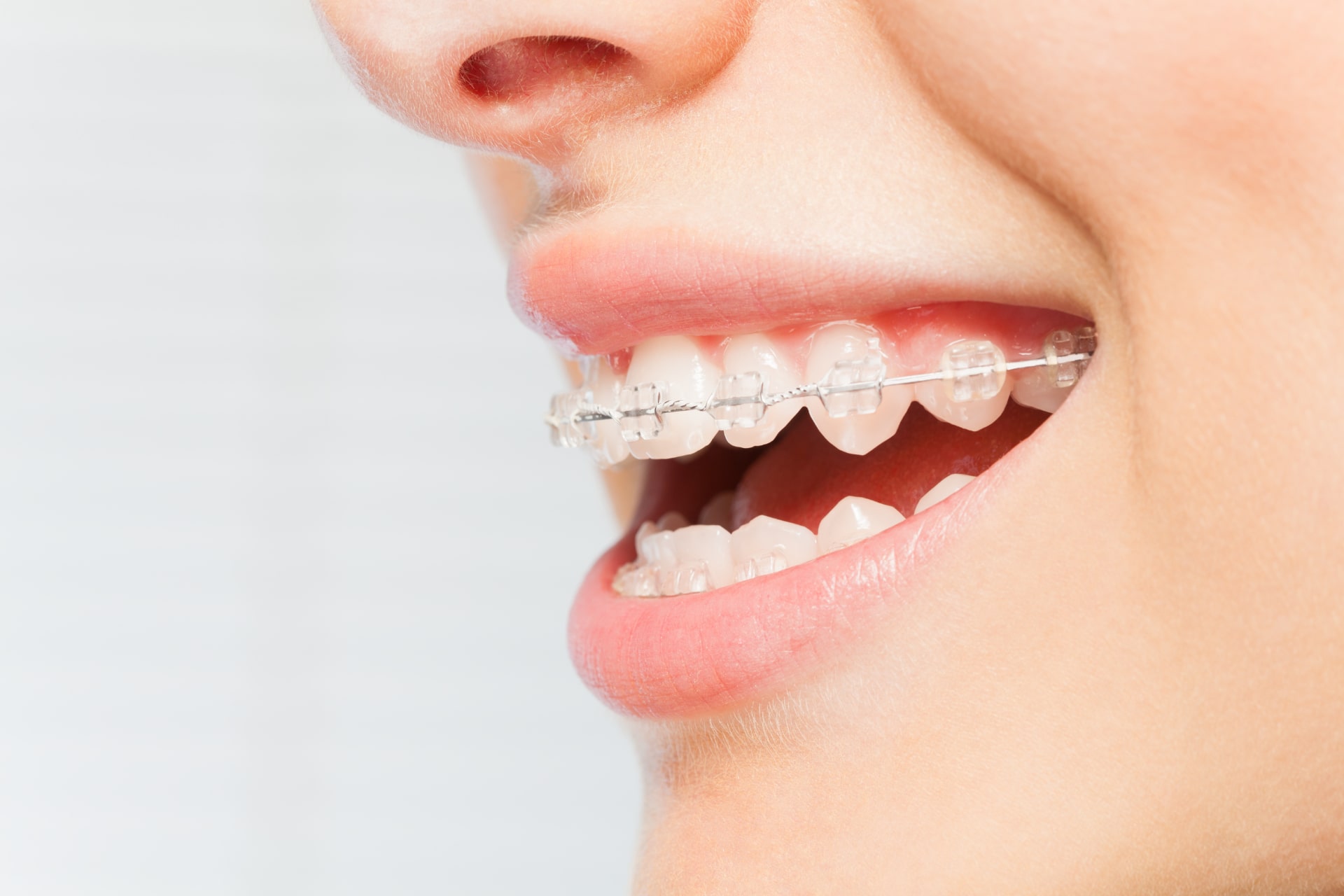 Knoxville Orthodontist
